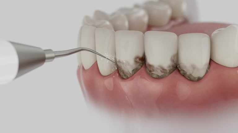 Reliable Dental contractor in Aberdeen, MD by Smile Center Dentistry